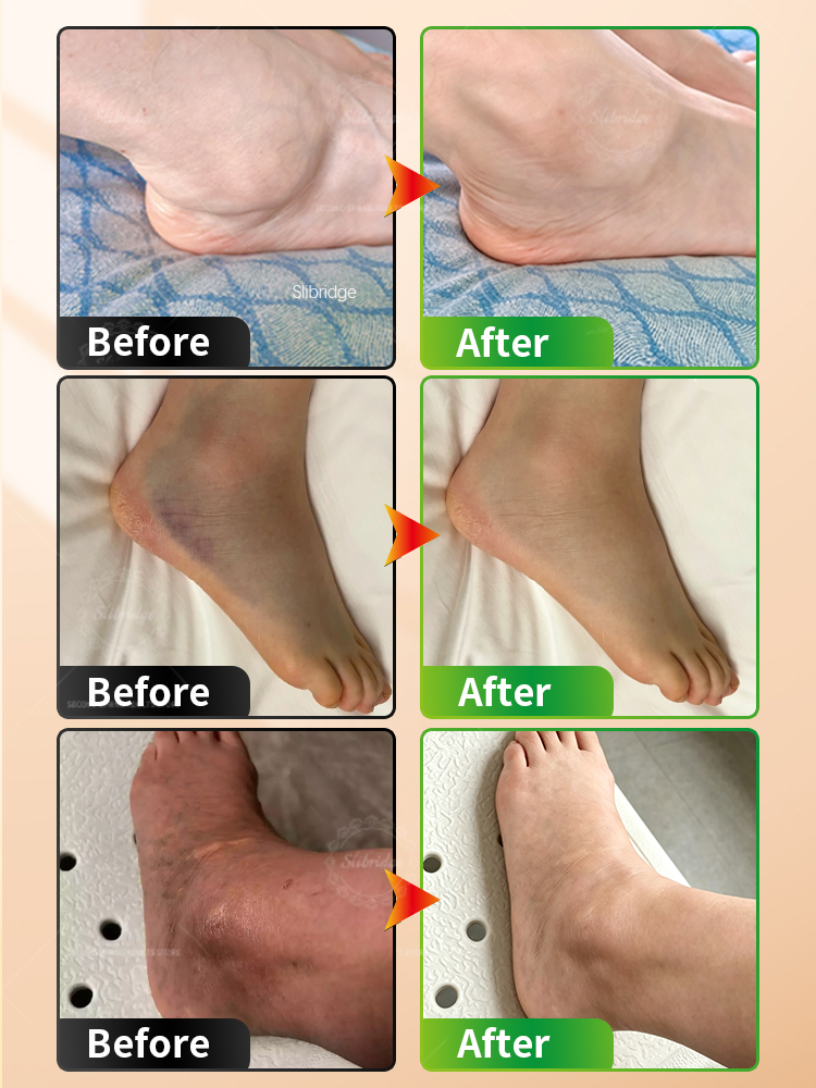 Portable Heated Ankle Massager - Ankle Mobility Band review and price